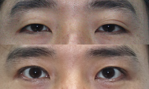 슬라이드26